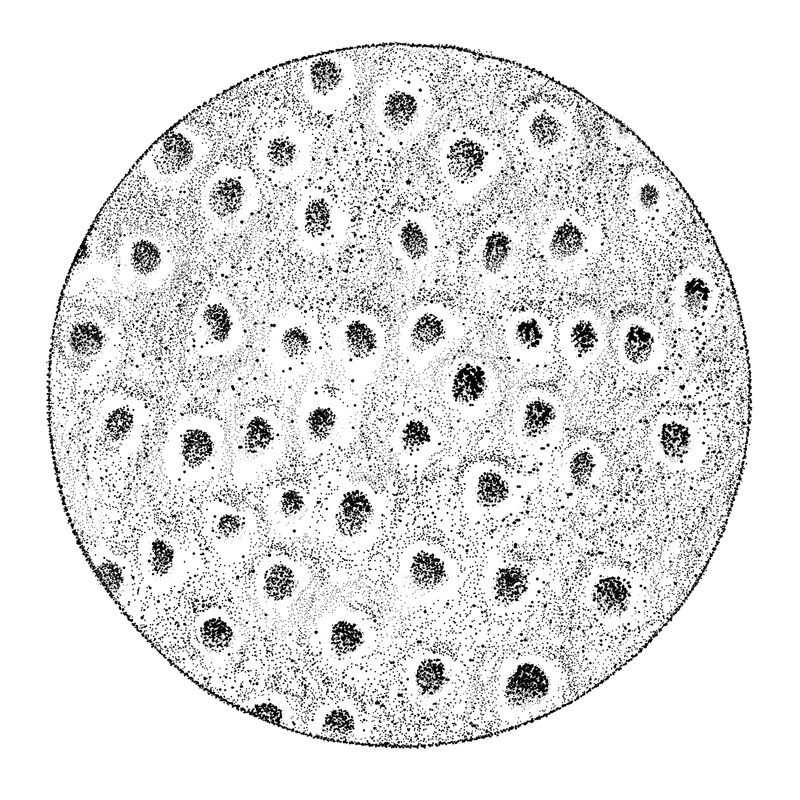 Circular stippled view of porous enamel with exposed dentinal tubules, before Rennou®